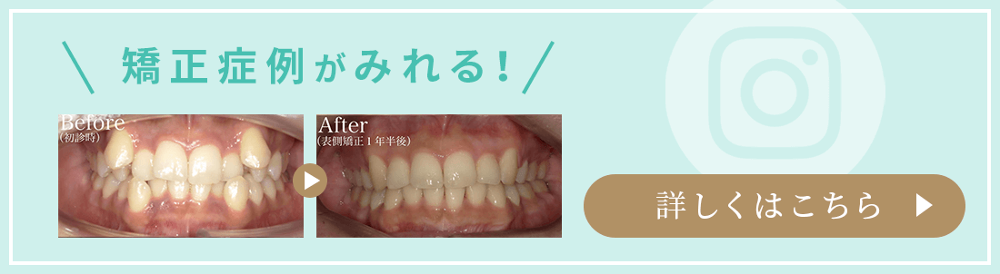 矯正症例がみれる！詳しくはこちら